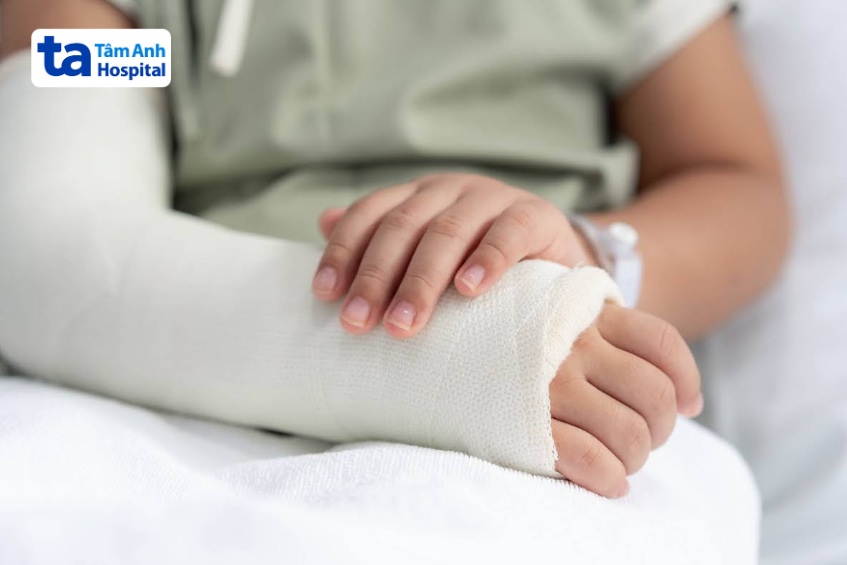 Gãy xương ở trẻ có thể xảy ra do nhiều nguyên nhân
