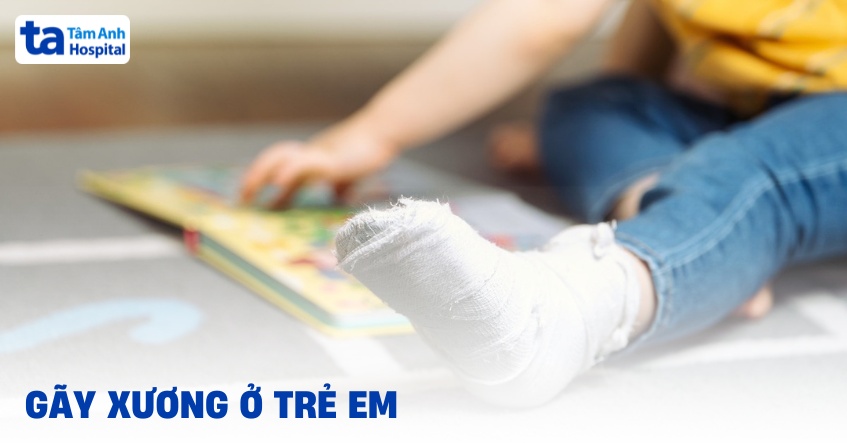 Gãy xương ở trẻ em gây ảnh hưởng như thế nào?