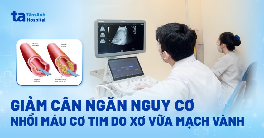 Giảm cân ngăn nguy cơ nhồi máu cơ tim do xơ vữa mạch vành