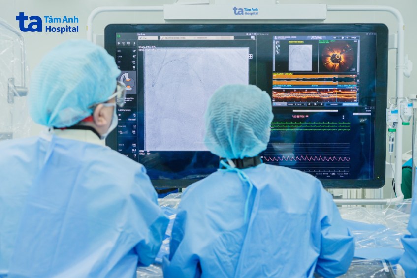 Giáo sư Nhân (bên trái) cùng êkíp đặt stent cho một người bệnh với sự hỗ trợ của chụp cắt lớp kết quang nội mạch (OCT)