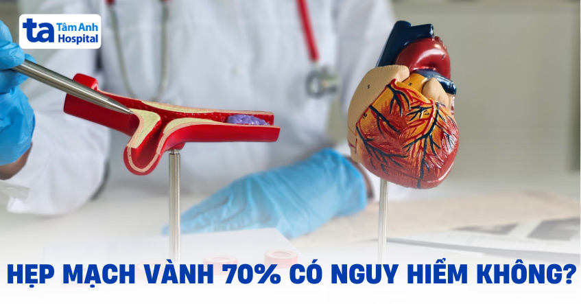 Hẹp mạch vành 70% có nguy hiểm không? Cách điều trị và chăm sóc
