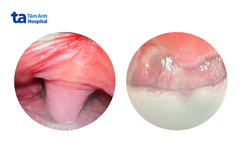 hình ảnh trước phẫu thuật