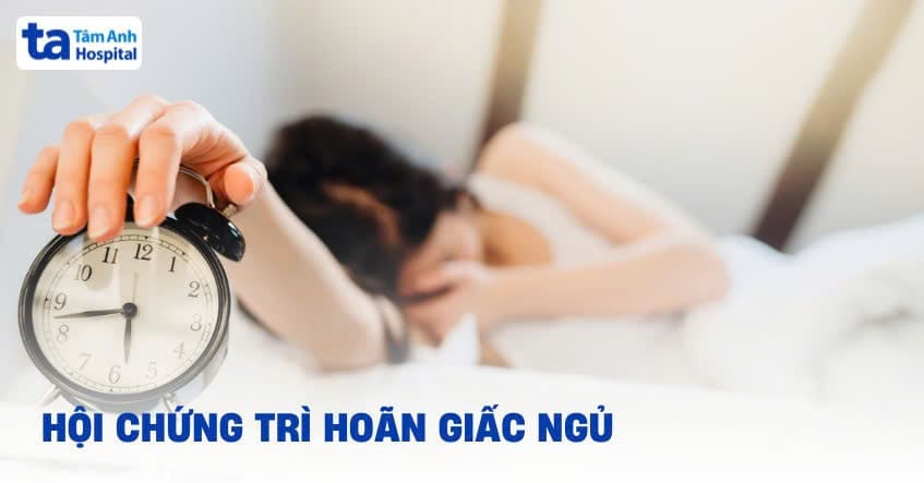 hội chứng trì hoãn giấc ngủ