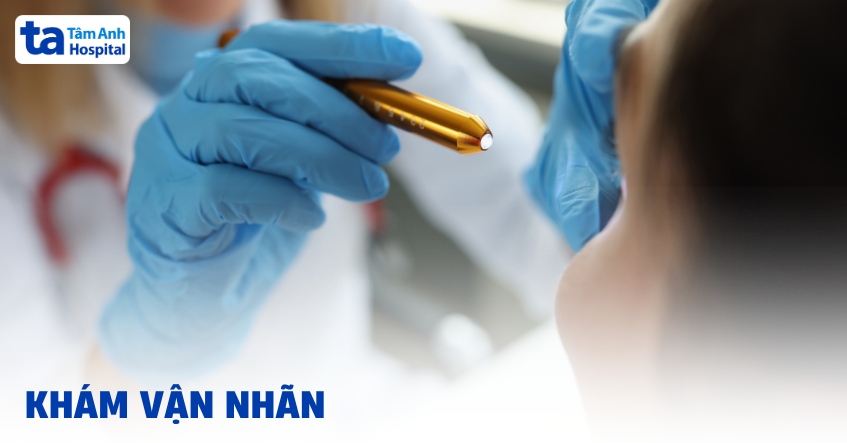 Khám vận nhãn (dây thần kinh số 3, 4, 6) là gì? Tìm hiểu chi tiết