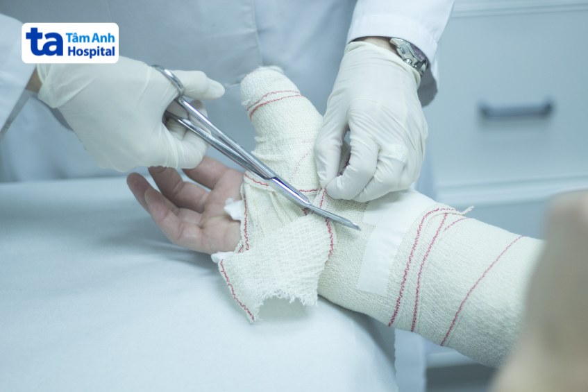 Khi xương của trẻ đã lành lại, bác sĩ sẽ chỉ định tháo bột cho trẻ