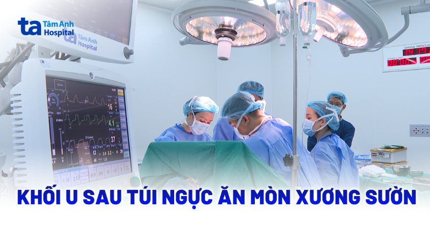 Khối u sau túi ngực ăn mòn xương sườn người phụ nữ