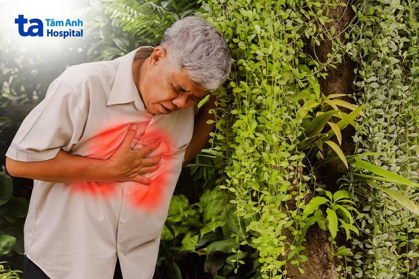 Lao gây dịch tràn màng phổi thường có nhiều dấu hiệu