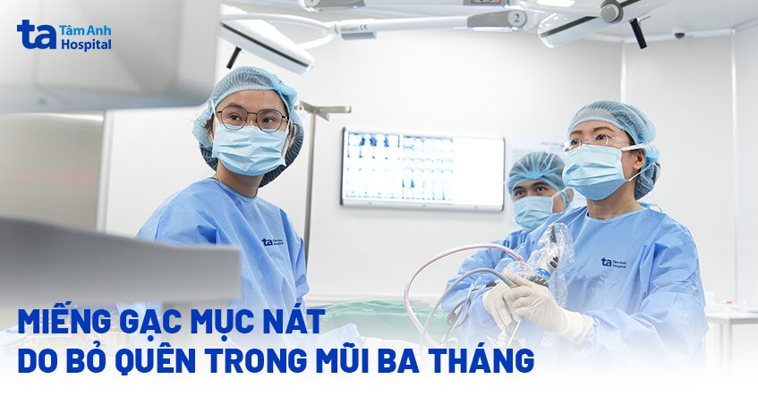 Miếng gạc mục nát do bỏ quên ba tháng trong mũi
