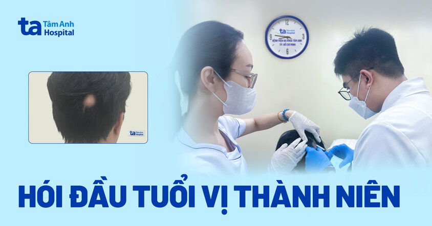 người bệnh bị hói đầu khi bước vào tuổi vị thành niên