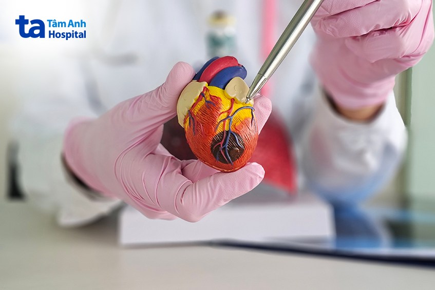 Người bệnh suy tim có nguy cơ cao bị tràn dịch màng phổi