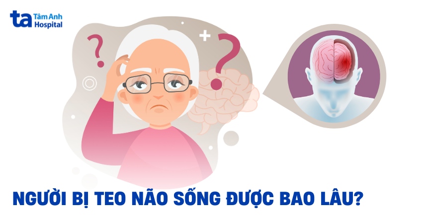 Người bị teo não sống được bao lâu? Cách hỗ trợ kéo dài tuổi thọ