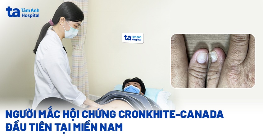 ngưới mắc hội chứng cronkhite canada đầu tiên tại miền nam