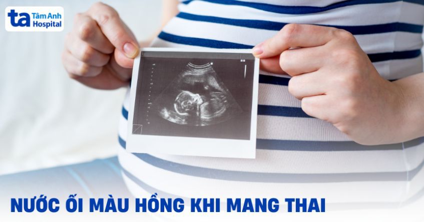 Nước ối màu hồng (nhạt, đậm, đỏ, đục) khi mang thai và cách xử lý