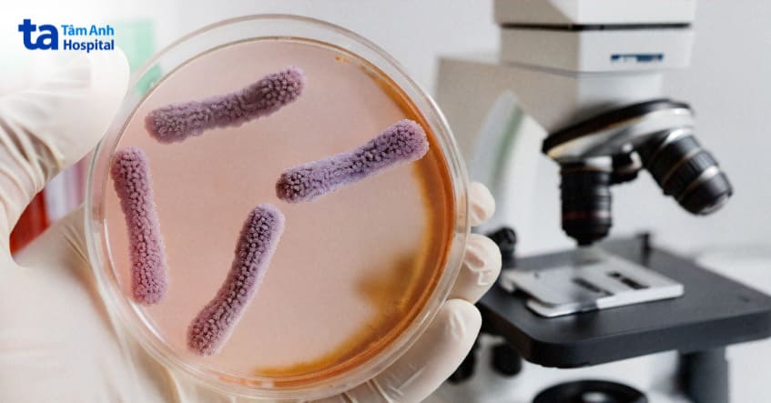 nuôi cấy nước tiểu để xác định loại vi khuẩn