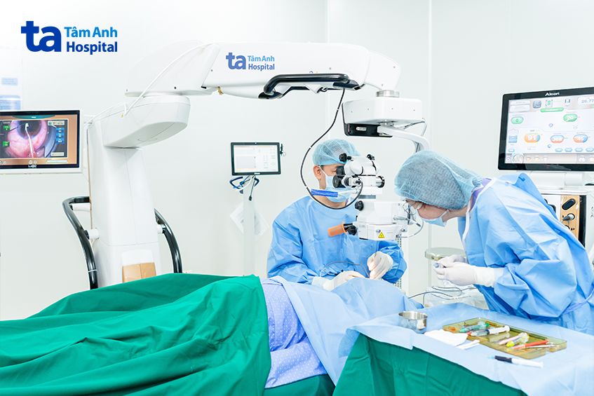 ông thừa được phẫu thuật phaco