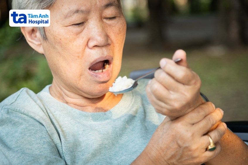parkinson ở người già nguy cơ biến chứng
