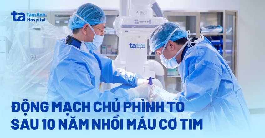 Phình động mạch chủ sau 10 năm nhồi máu cơ tim