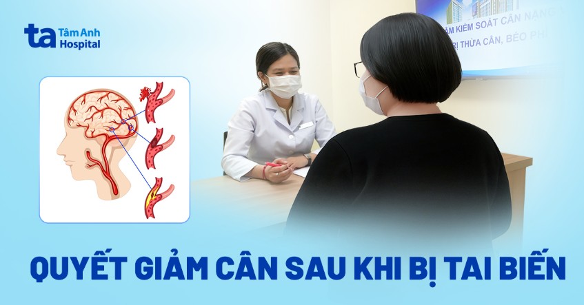 Quyết giảm cân sau khi bị tai biến
