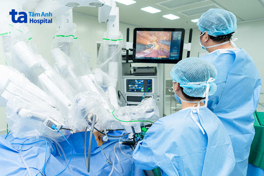 robot hỗ trợ cắt thận