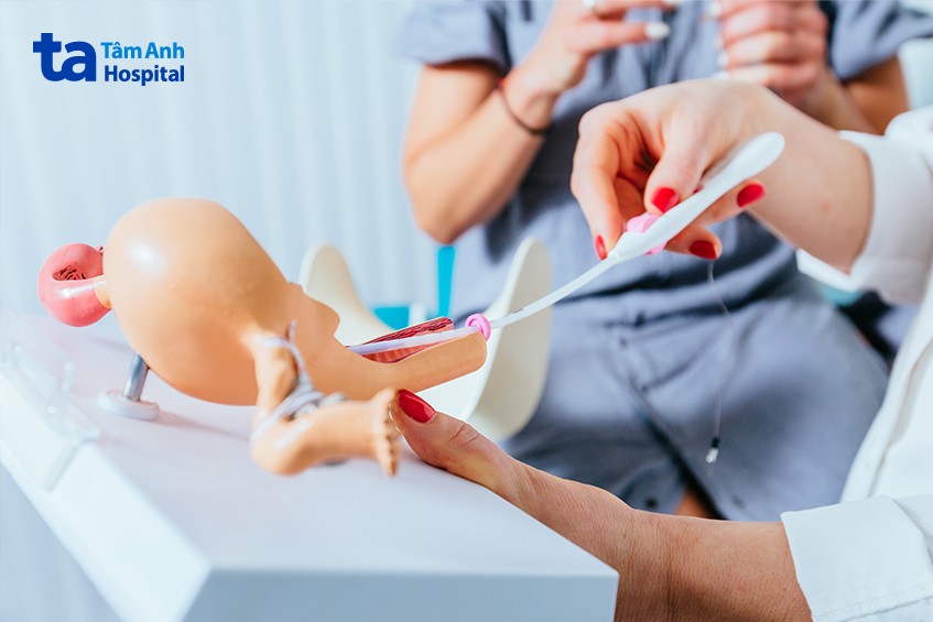 Sau chuyển phôi được 6 ngày ở một số phụ nữ đã xuất hiện dấu hiệu mang thai sớm