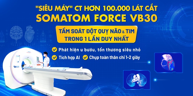 siêu máy CT tầm soát đột quỵ mb