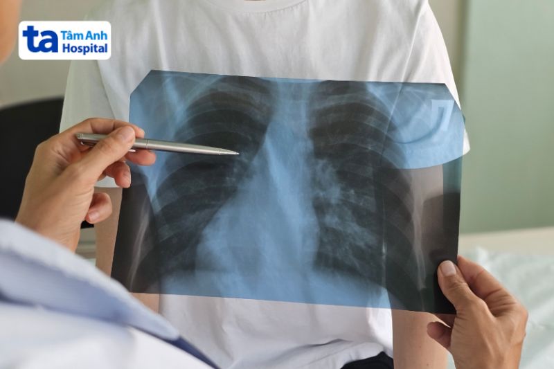 bệnh nhân cần đi khám khi ho kéo dài liên tục