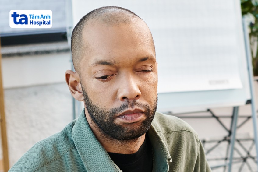 sụp mí cảnh báo bệnh nhược cơ