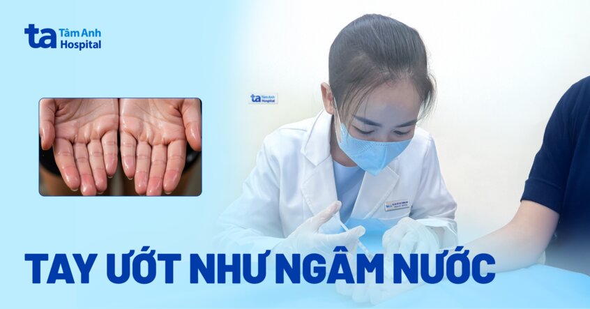 tay ướt như ngâm nước