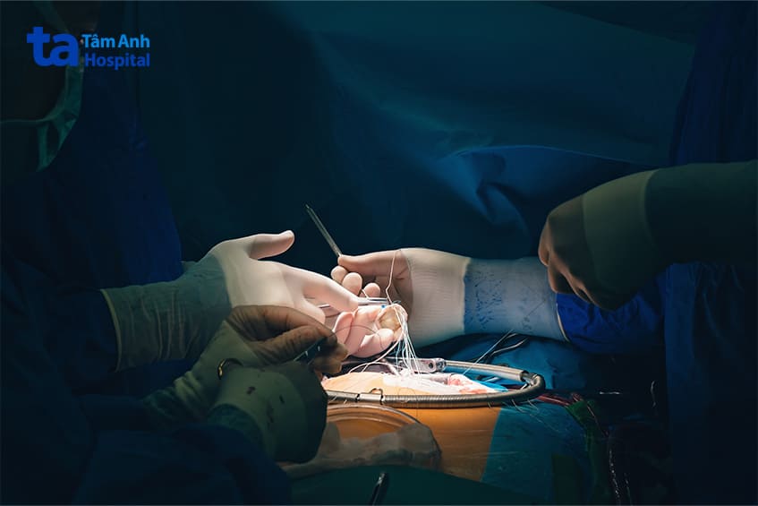 thay lại van tim khi có chỉ định của bác sĩ
