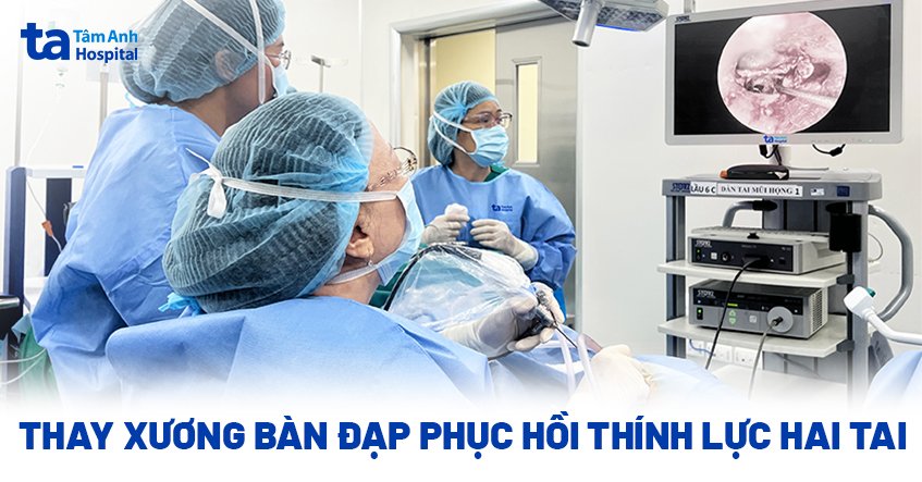Phục hồi thính lực sau thay xương bàn đạp nhân tạo