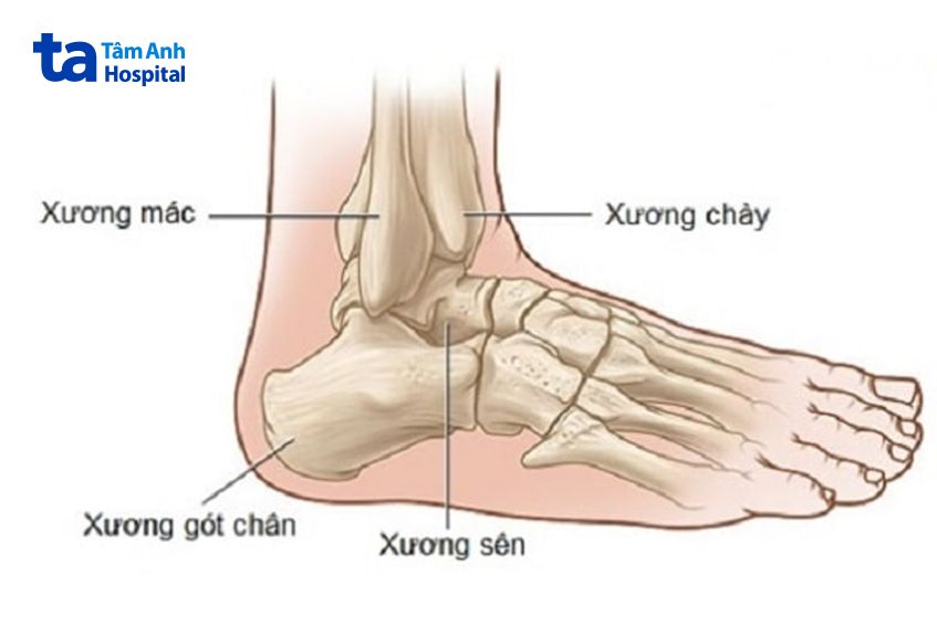 Đau do tổn thương xương sên gây