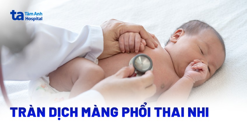 Như thế nào là tràn dịch màng phổi thai nhi?