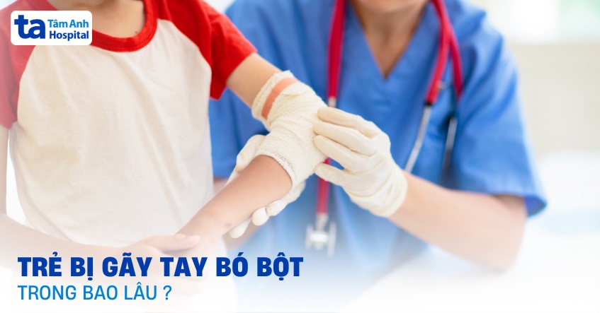 Trẻ bị gãy tay bó bột trong bao lâu? Khi nào gỡ bỏ được?