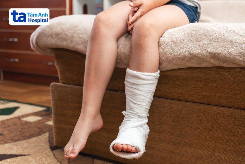 Trẻ có thể cần bó bột để cố định vết thương