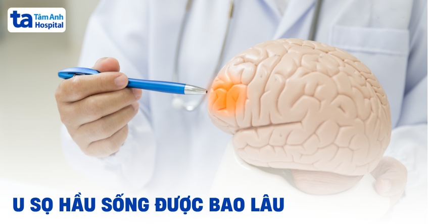 U sọ hầu sống được bao lâu? Yếu tố ảnh hưởng đến tiên lượng bệnh