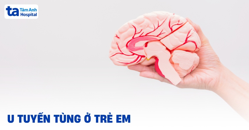 u tuyến tùng ở trẻ em