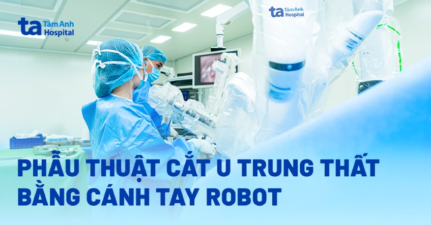 Cắt u tuyến ức không triệu chứng băng robot