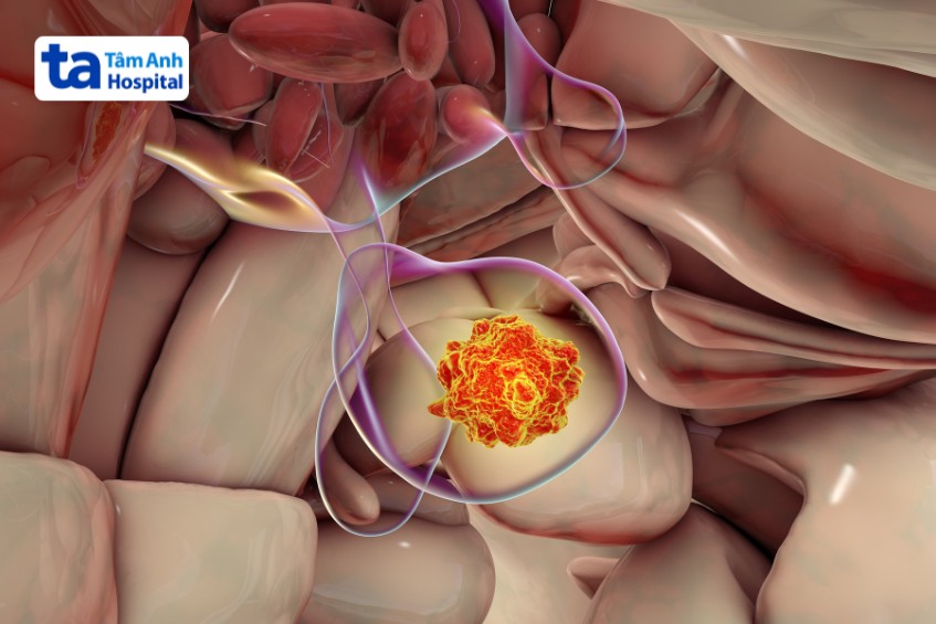 u vùng tuyến yên có thể gây vô sinh cả nam và nữ