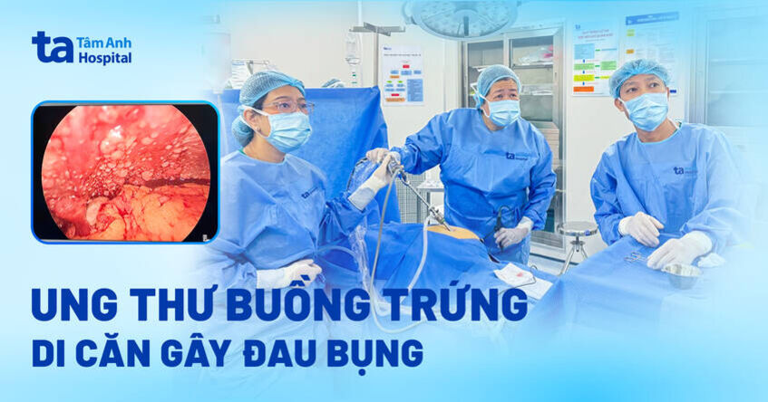 ung thư buồng trứng di căn gây đau bụng