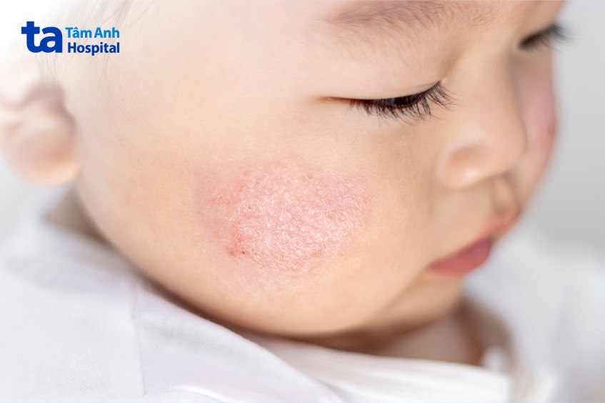 Vì sao việc chăm sóc trẻ sơ sinh vào mùa đông