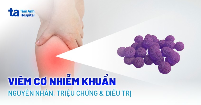Viêm cơ nhiễm khuẩn: Nguyên nhân, triệu chứng và điều trị