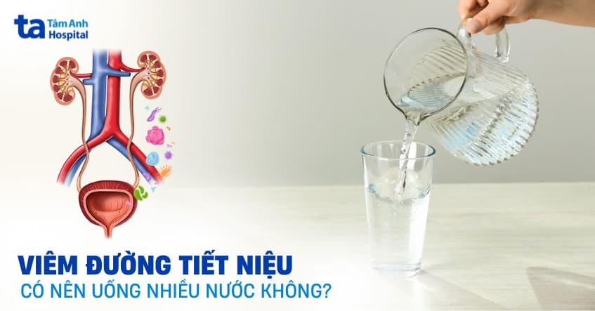 Viêm đường tiết niệu có nên uống nhiều nước không? Uống như thế nào?