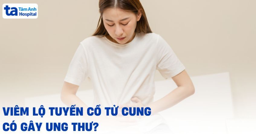 Viêm lộ tuyến có gây ung thư không? Khi nào nên điều trị?