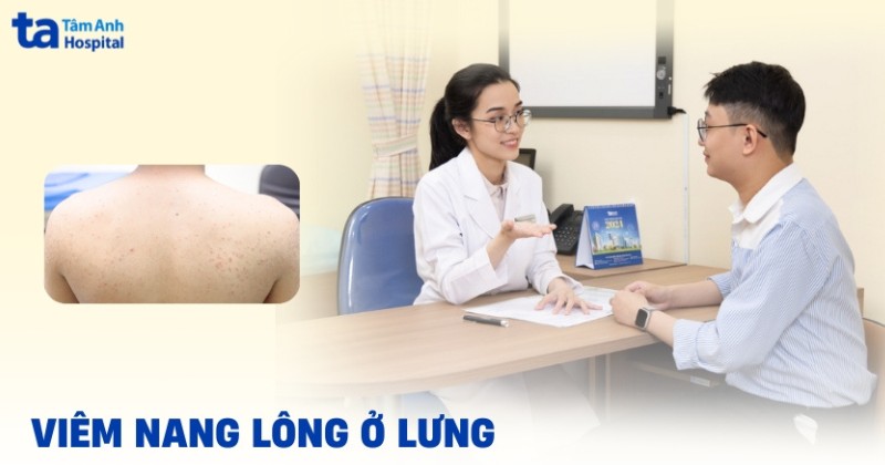 Viêm nang lông ở lưng: Nguyên nhân, hình ảnh, điều trị