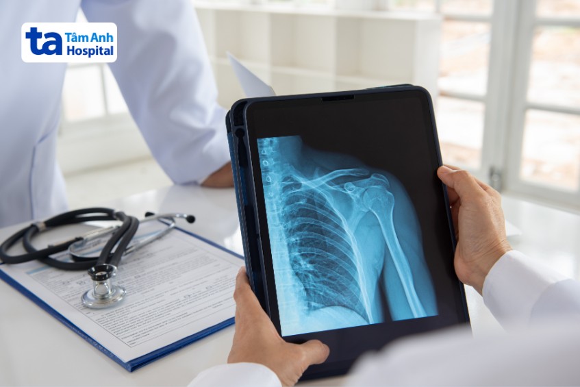 Nguyên Nhân Bị Đau Sau Lưng Bên Trái Dưới Bả Vai Và Các Cách Xử Lý Xét Nghiệm Hình Ảnh Xác Định Nguyên Nhân Đau