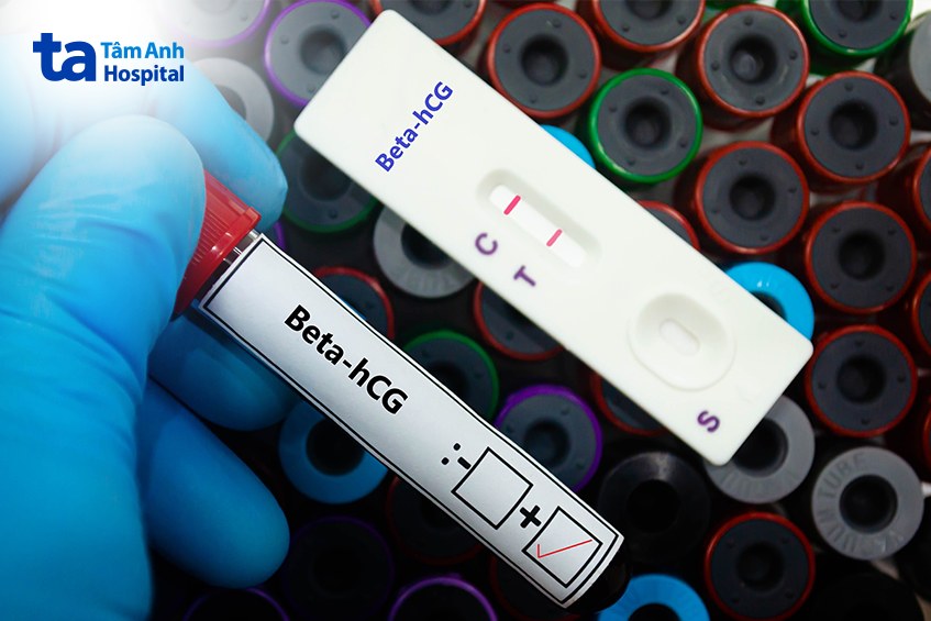 Kiêng nhẫn chờ đến ngày xét nghiệm beta hCG để biết kết quả có thai chính xác nhất