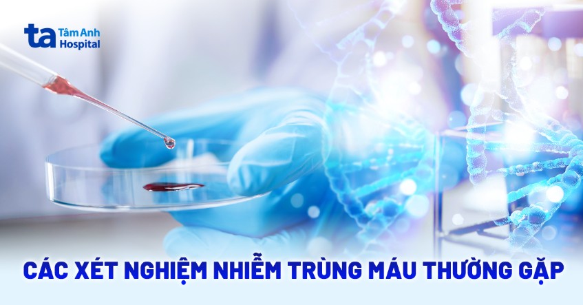 Các xét nghiệm nhiễm trùng máu hiệu quả người bệnh cần biết rõ