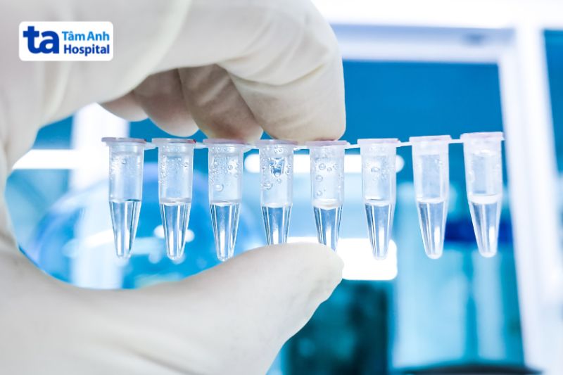 xét nghiệm ống PCR