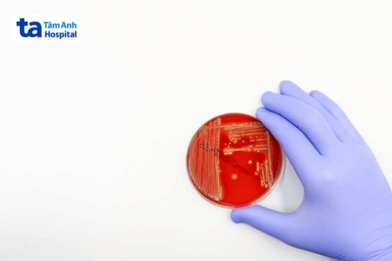xét nghiệm máu phát hiện sốt thương hàn