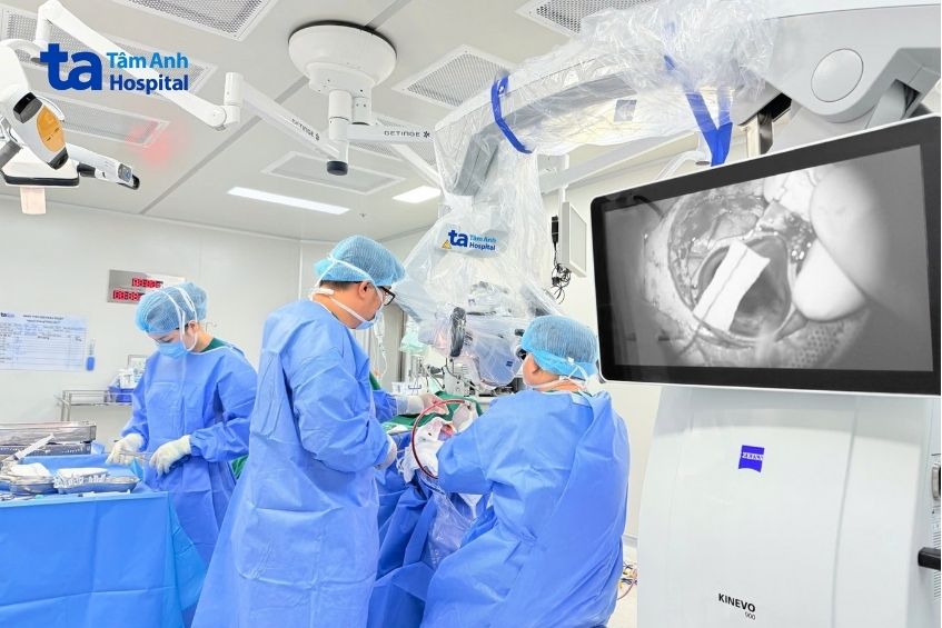 Bác sĩ đang phẫu thuật lấy khối máu tụ cho ông Nghĩa bằng kỹ thuật xâm lấn tối thiểu.